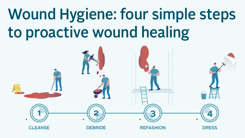 Wound Hygiene: four simple steps to proactive healing