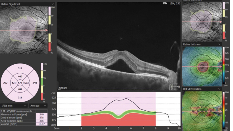 OCT masterclass 2: Understanding the data