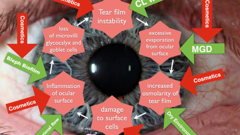 TFOS Lifestyle Part 2 – Impact of cosmetics on the ocular surface