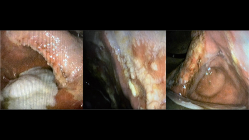Equine gastric ulcer syndrome and the challenges facing clinicians