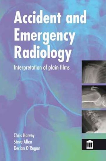 Picture of Accident and Emergency Radiology: Interpretation of Plain Films