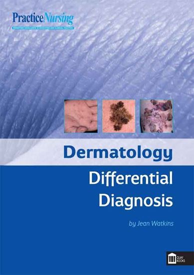 Picture of Dermatology Differential Diagnosis